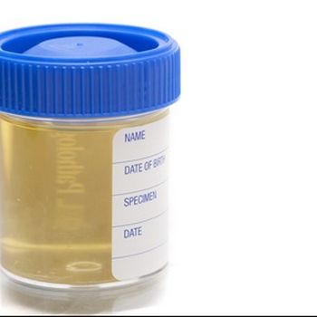 Internal dosimetry: Urinalysis