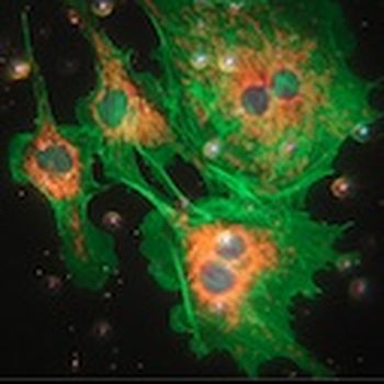 Microscope slide staining