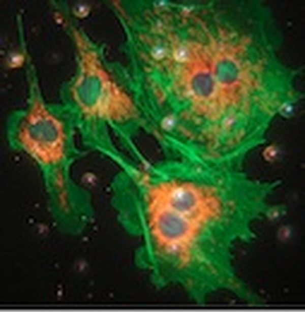 Microscope slide staining