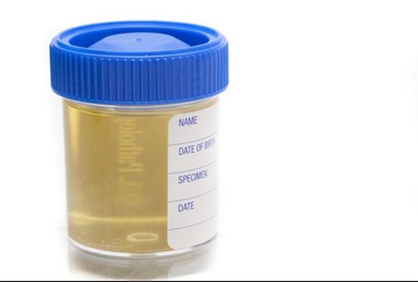 Internal dosimetry: Urinalysis