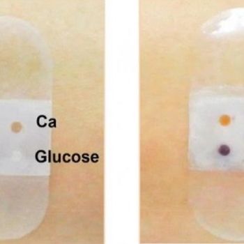 Biosensor 'bandage'