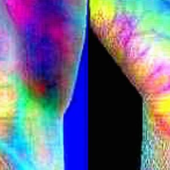 Hyperspectral imaging