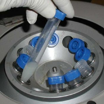 Centrifugation