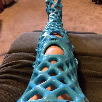 ActivArmor 3D Printed Casts